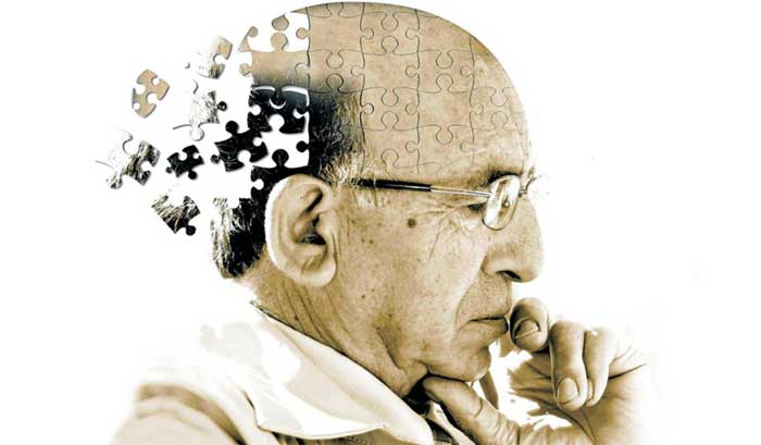 بیماری آلزایمر